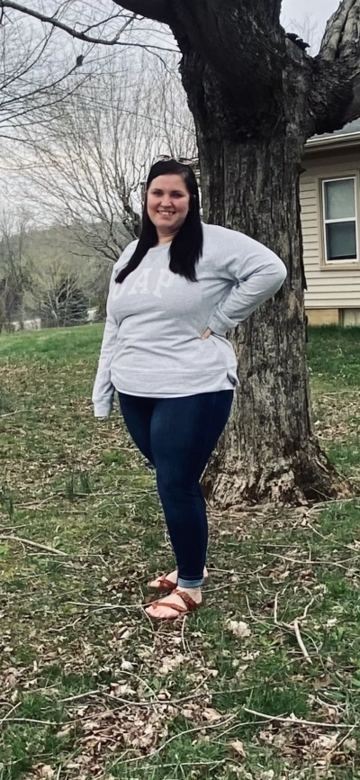 Amanda Collett before weight loss surgery Amanda Collett before weight loss surgery